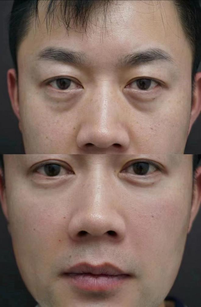 护肤品推荐专业测评值得信赖九游会网址是多少淡纹抗皱