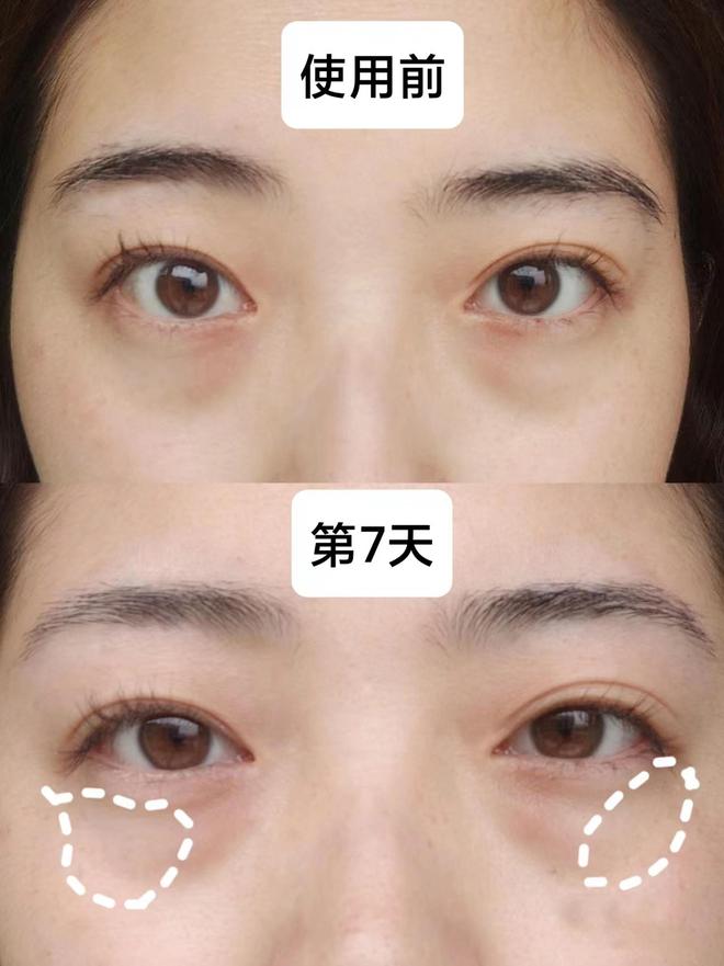 袋哪个牌子好？秋冬眼霜上岸指南少走弯路j9九游会入口首页25岁男士眼霜去眼(图8)