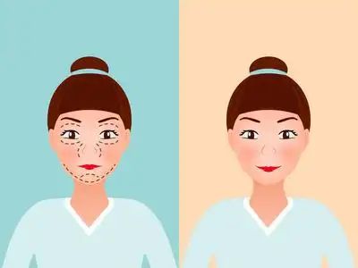 项目比较好？几天见效术后案例医院j9国际站登录想要眼部提升做什么